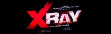 X Ray Movie